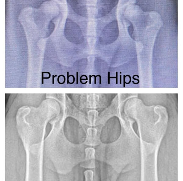 Hip X-ray image